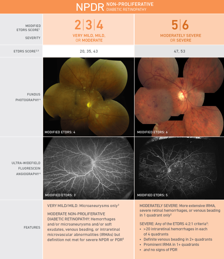 Fundus photography and ultra-widefield fluorescein angiography